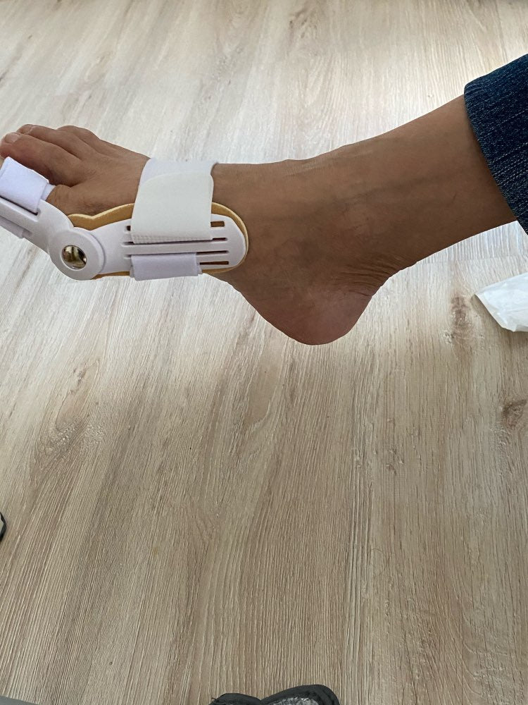 Pied d’Isabelle avec le correcteur Pedineo®