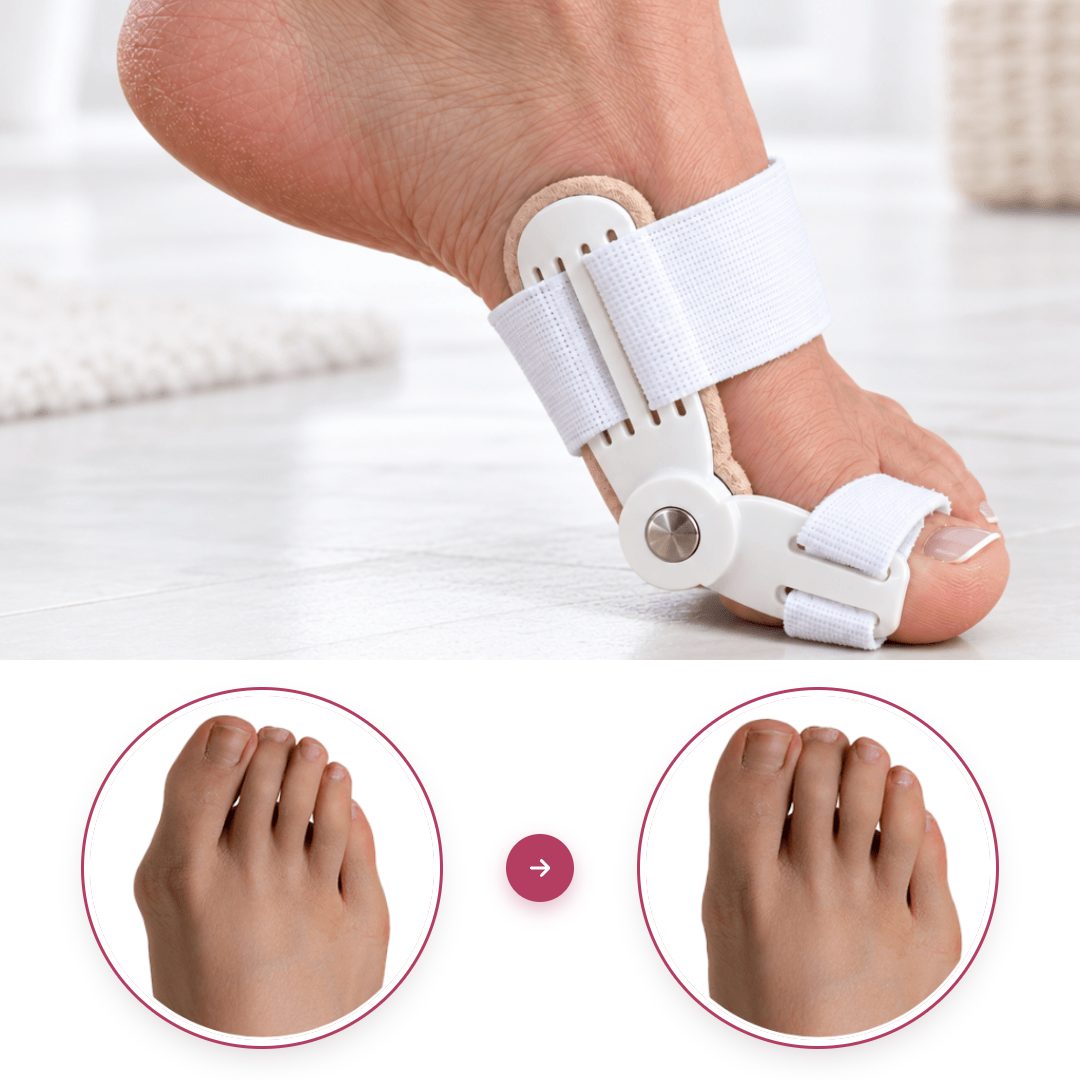 Pied portant le correcteur Pedineo®